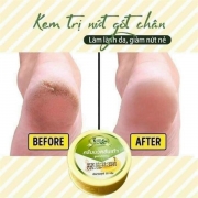 KemtrntgtchnchuiBananaThiLan30g