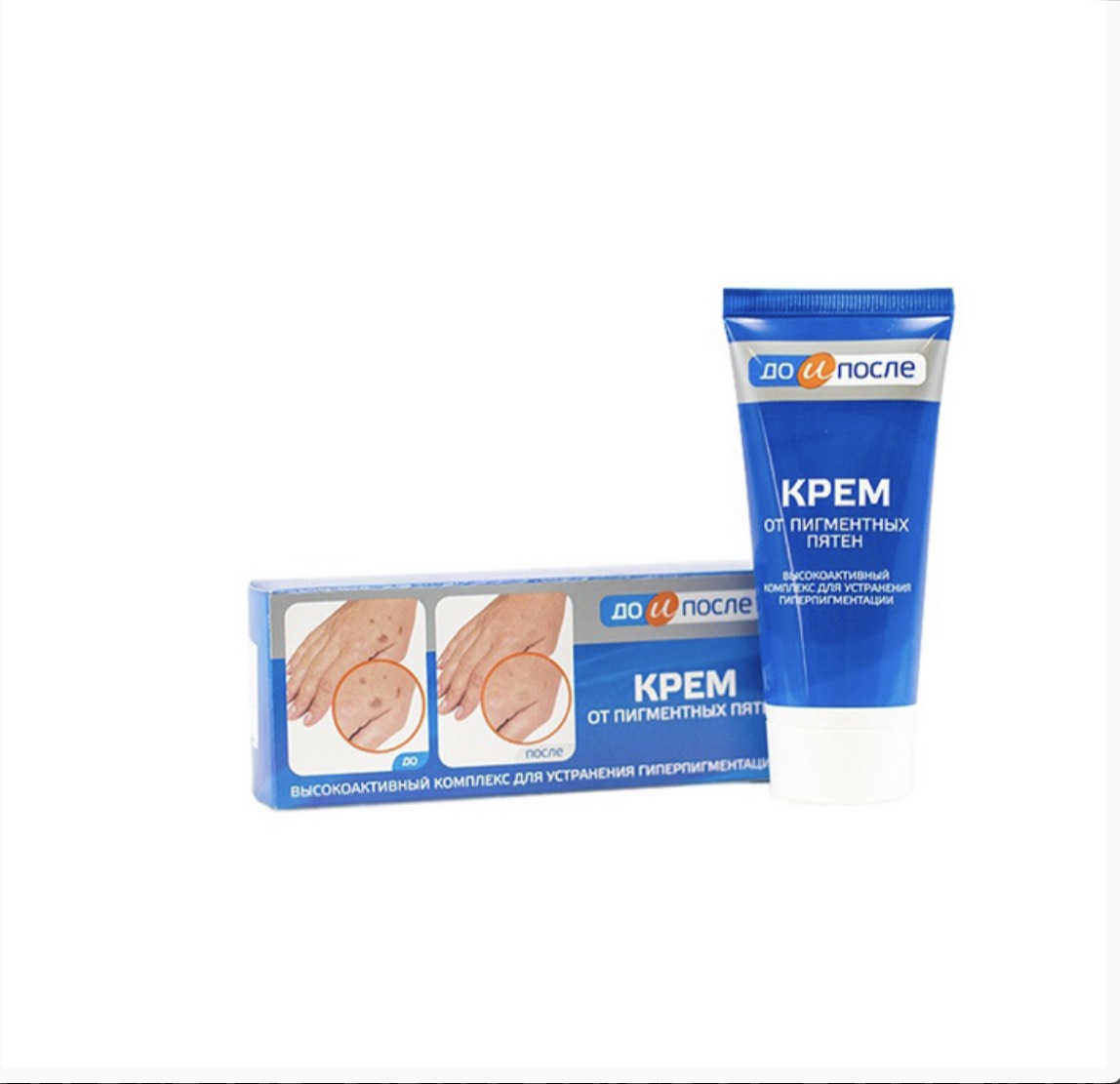 Kem trị đồi mồi tay KPEM của Nga